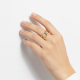 Noris ring